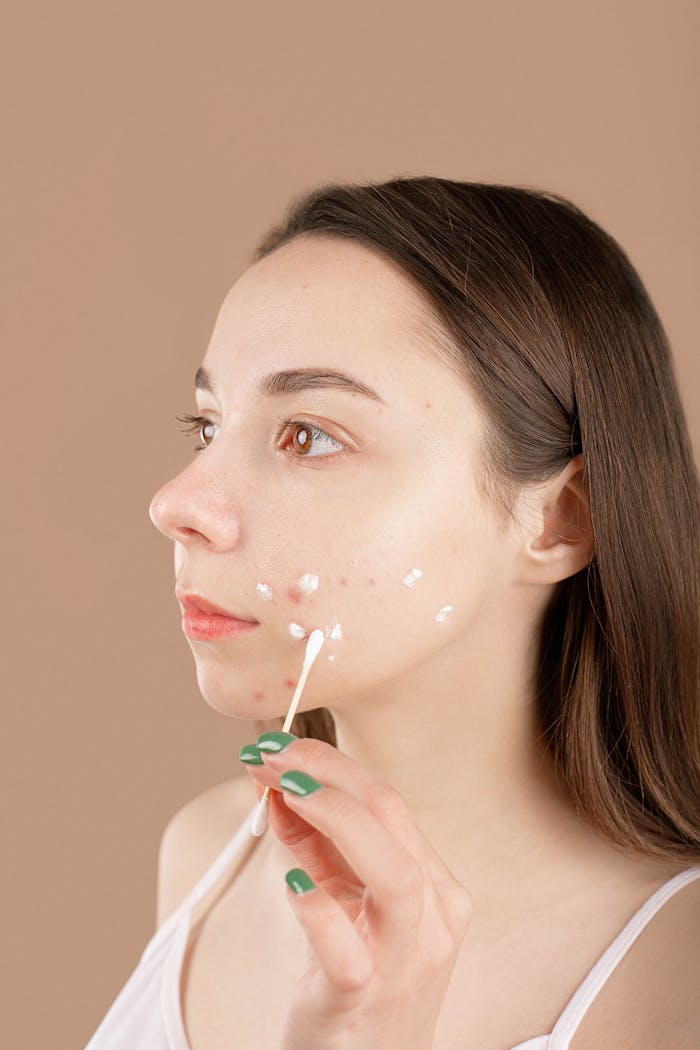 about-us-02 A young woman applies acne treatment cream on her face, focusing on skincare and facial care.