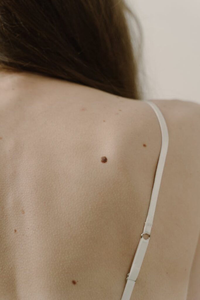 pexels-photo-6568221 Detailed portrait of a woman's back showing skin moles and white straps in a neutral setting.